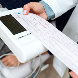Doctor holds ECG printout from machine.